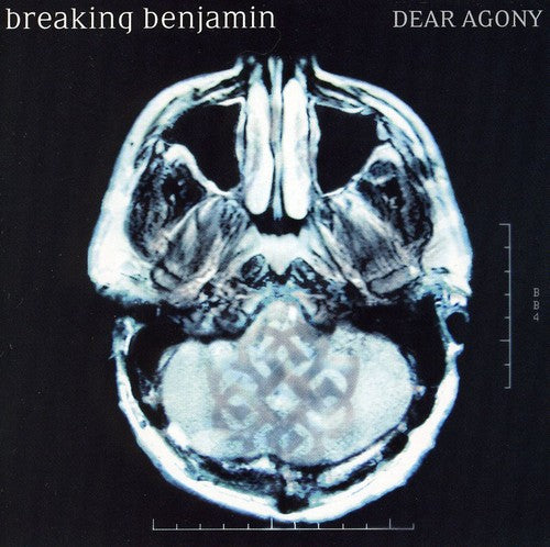 Breaking Benjamin: Dear Agony