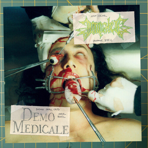 Impaled: DEMO MEDICALE