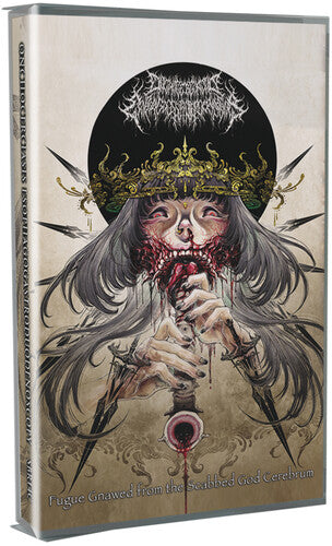 Onchocerciasis Esophagogastroduodenoscopy: Fugue Gnawed From The Scabbed God Cerebrum - CASSETTES