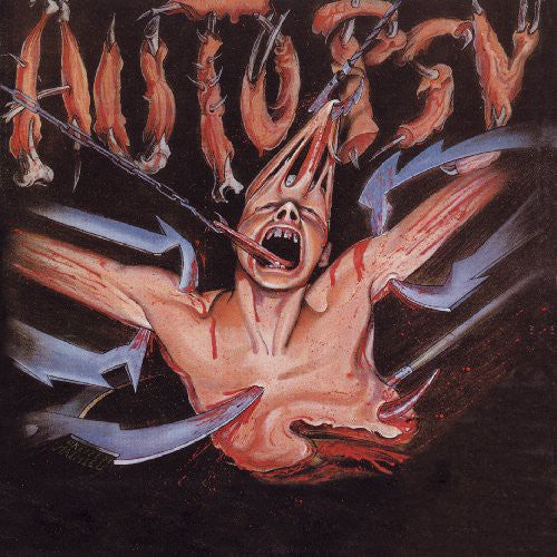 Autopsy: Severed Survival